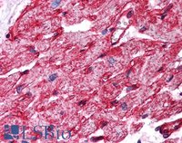 EB06817-T 2
