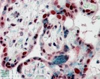 EB06959-T 2