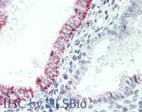 EB06767 2