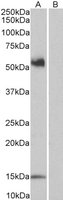 EB07103-T 1