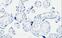 EB06621 3