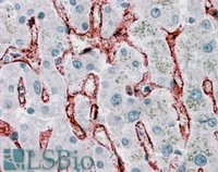 EB06695 2