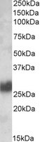 EB09463 1