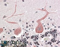 EB06363 1