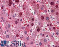 EB07094-T 2