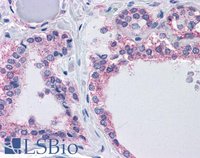 EB09314 2