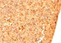 EB06894 1