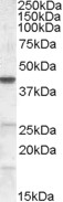 EB07657 1
