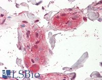 EB10968 2
