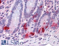 EB07271-T 3