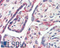 EB06229 2