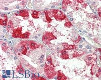 EB09305 2