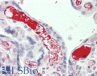 EB11703 1