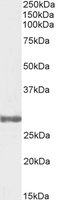 EB07357-B 1