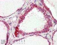 EB07914 2
