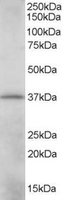 EB05254 1
