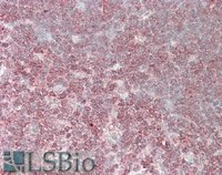 EB05254-T 2