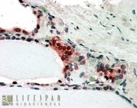 EB05953 2