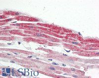 EB09412 2