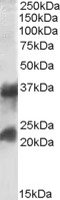 EB08878 1
