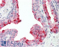 EB12230 2