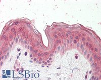 EB10490 2