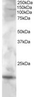 EB05429 1
