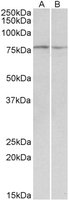 EB10102 2