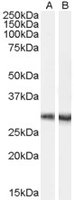 EB07463 1