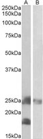 EB10446 2