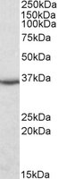 EB05278 1