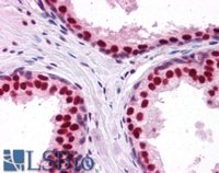 EB06310-T 2