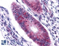 EB06310-T 3