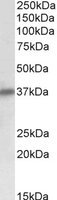 EB10758 1