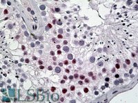 EB05240 1