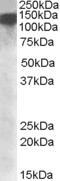 EB09297 1