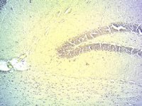EB07628 3