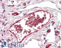 EB06940 2