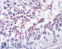 EB05320 1