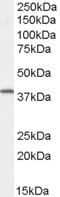 EB05367 1