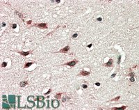 EB06656 2