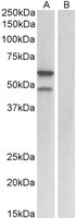 EB09935 1