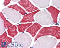 EB07292 2