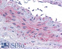 EB09590 4
