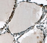 EB05511 1