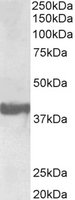 EB11694-B 1