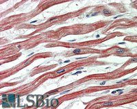 EB09492 1