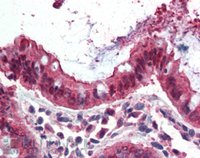 EB07305 2