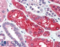 EB07305-T 3