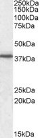 EB09489 1